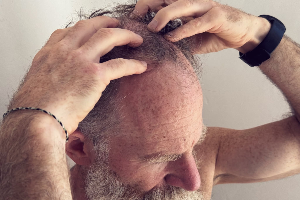 Itchy Scalp: Common Causes and What Really Helps